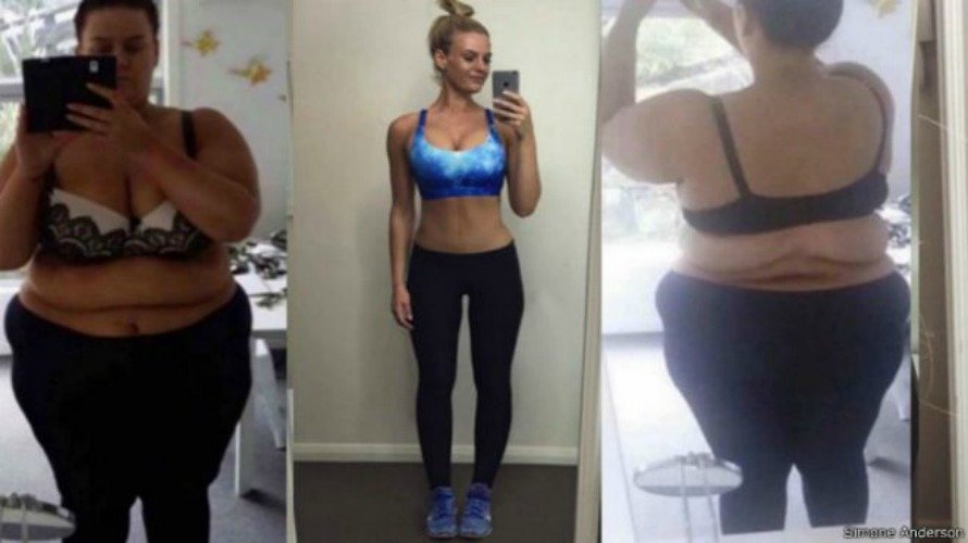 La increíble transformación tras perder 88 kilos en 20 meses.