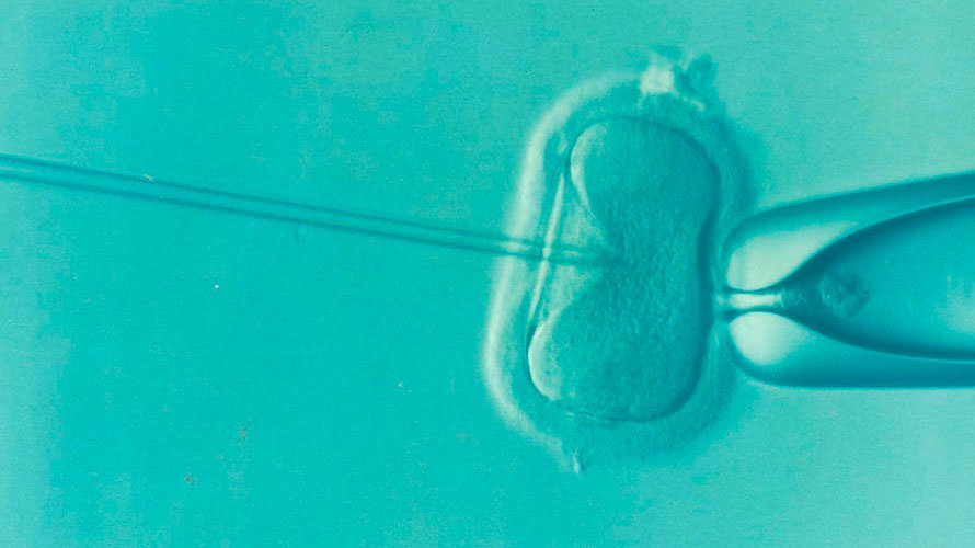 Imagen de una fecundación in vitro. ARCHIVO