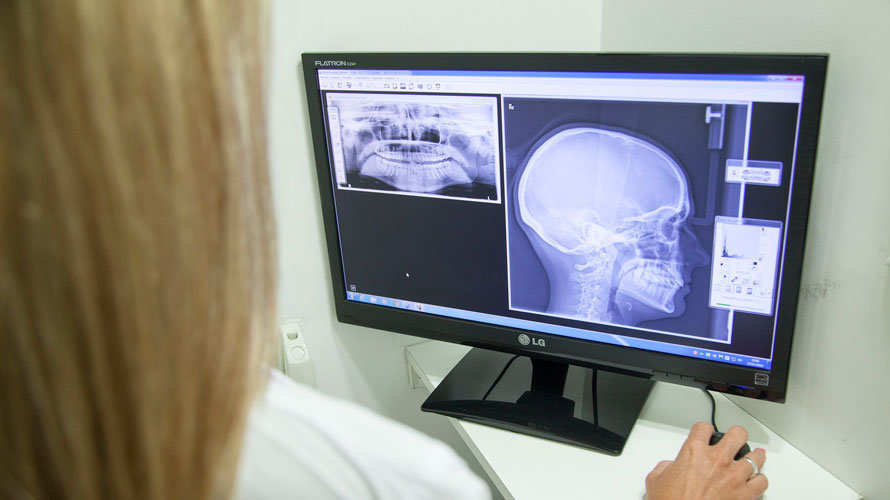 Una doctora mirando una radiografía en una consulta. ARCHIVO