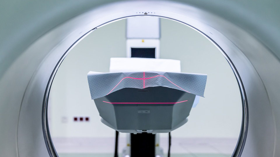 Imagen de los dispositivos para practicar una resonancia magnética a un paciente ARCHIVO