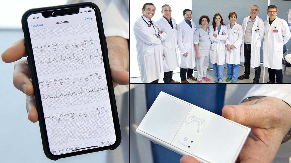 Profesionales del Área del Corazón y el Servicio de Neurología del CHN presentan una prueba mediante una app móvil para evaluar el riesgo de padecer ictus GOBIERNO DE NAVARRA 1