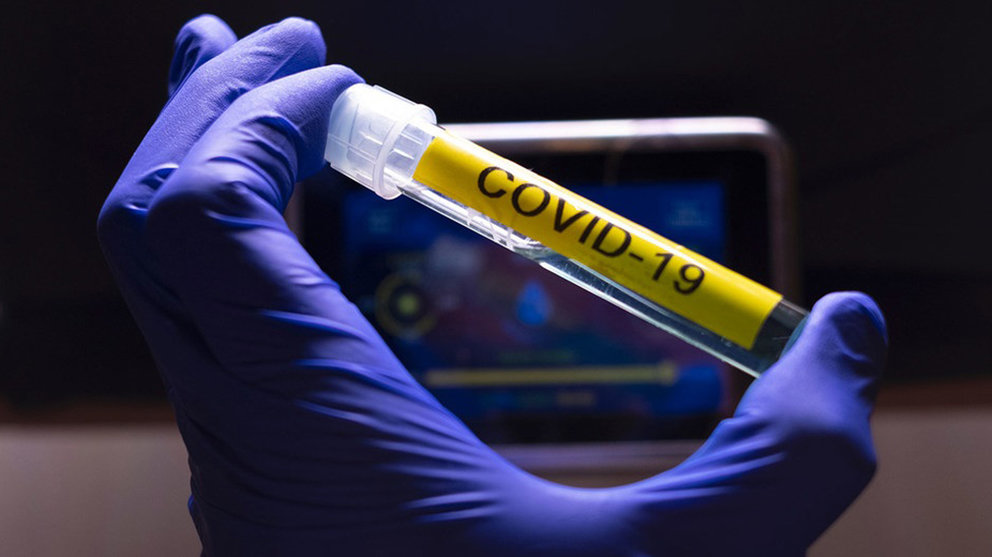 Recogida de muestra de Covid-19 para laboratorio. ARCHIVO