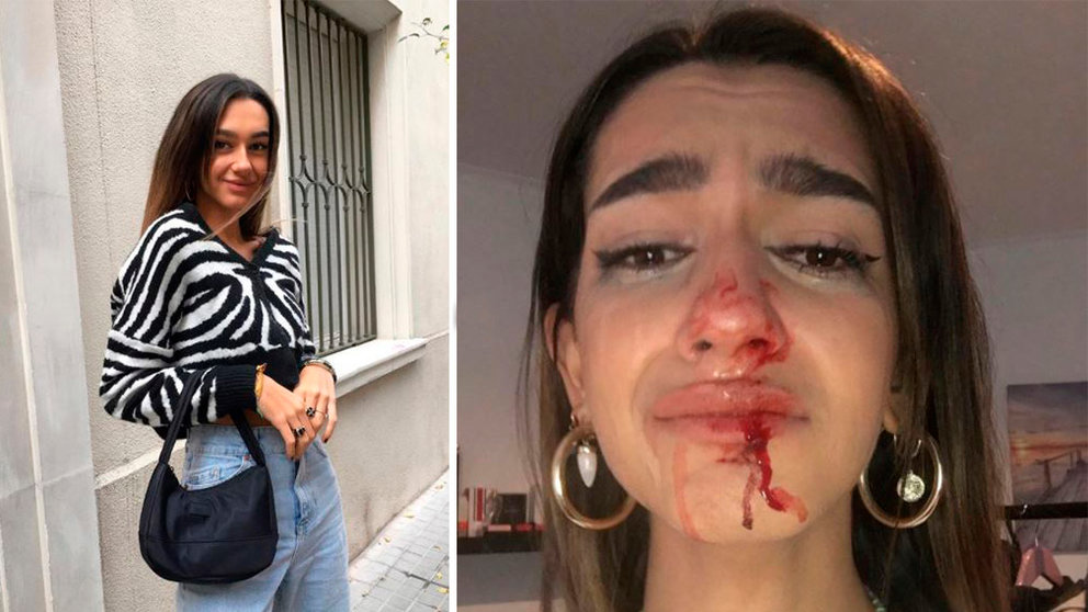 Imágenes de la joven pamplonesa, Eva Vildosola, que ha denunciado una agresión por ser transgénero en Barcelona INSTAGRAM (@evacastt)