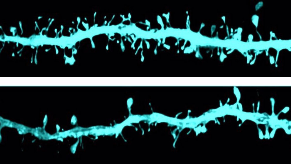 Imagen microscópica de las espinas dendríticas donde se observan las diferencias en la morfología de las fibras dopaminérgicas entre un grupo control (imagen superior) y un grupo experimental (imagen inferior). - CIMA UNIVERSIDAD DE NAVARRA