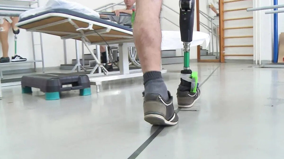 Una persona camina con una prótesis tras amputarle una pierna.EUROPA PRESS