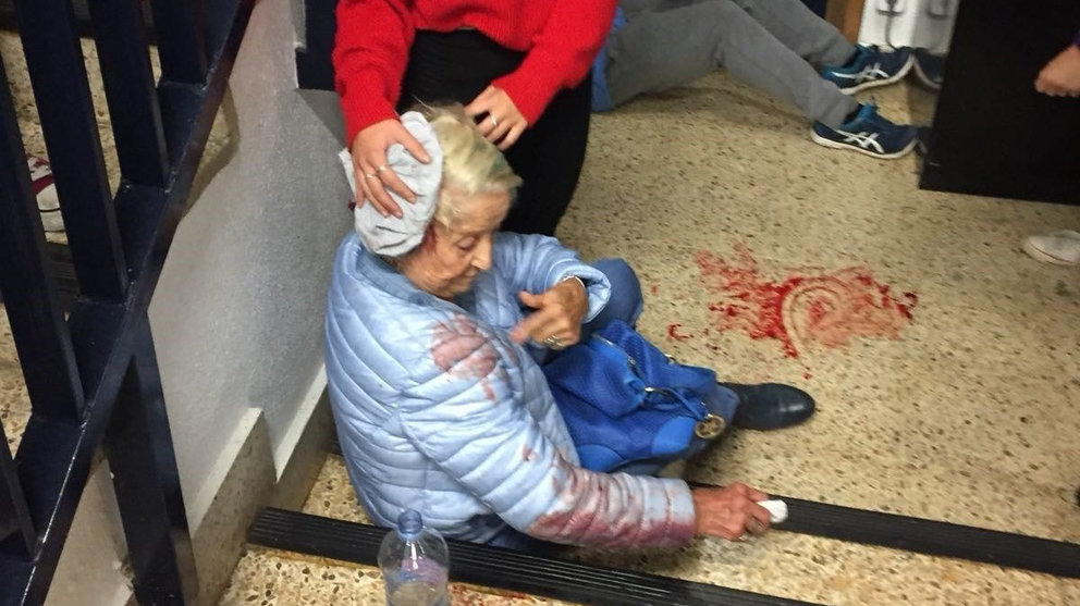 Una anciana herida en un colegio electoral durante el referéndum ilegal de Cataluña EP