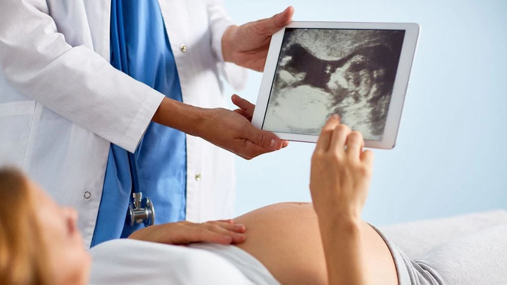 Imagen de una mujer embarazada observando una ecografía con el ginecólogo ARCHIVO 1