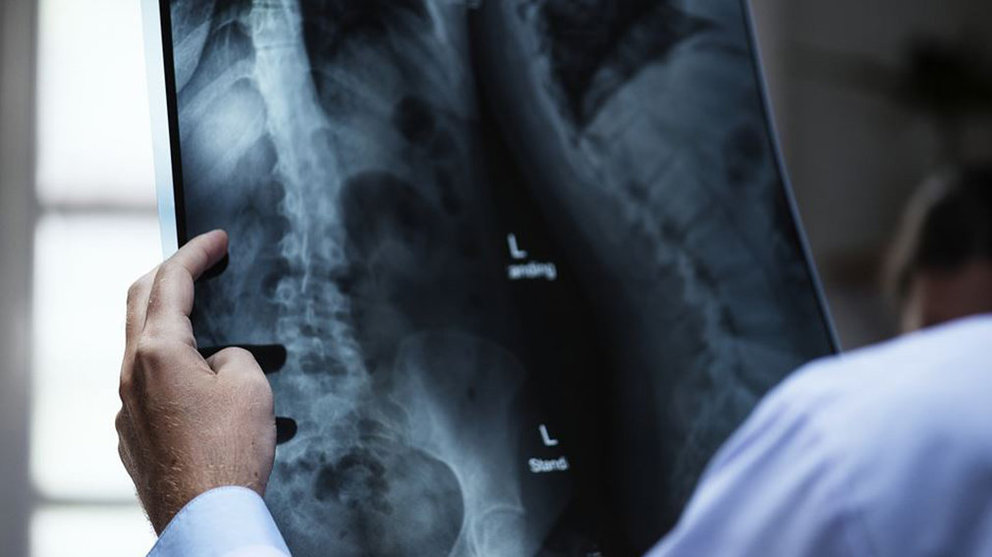 Un médico sostiene una radiografía ARCHIVO