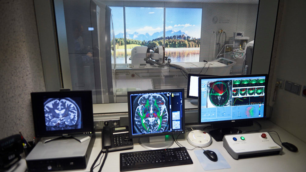 La Clínica Universidad de Navarra presenta un nuevo equipamiento para tratar el temblor esencial y la enfermedad de Parkinson sin cirugía. MIGUEL OSÉS 3