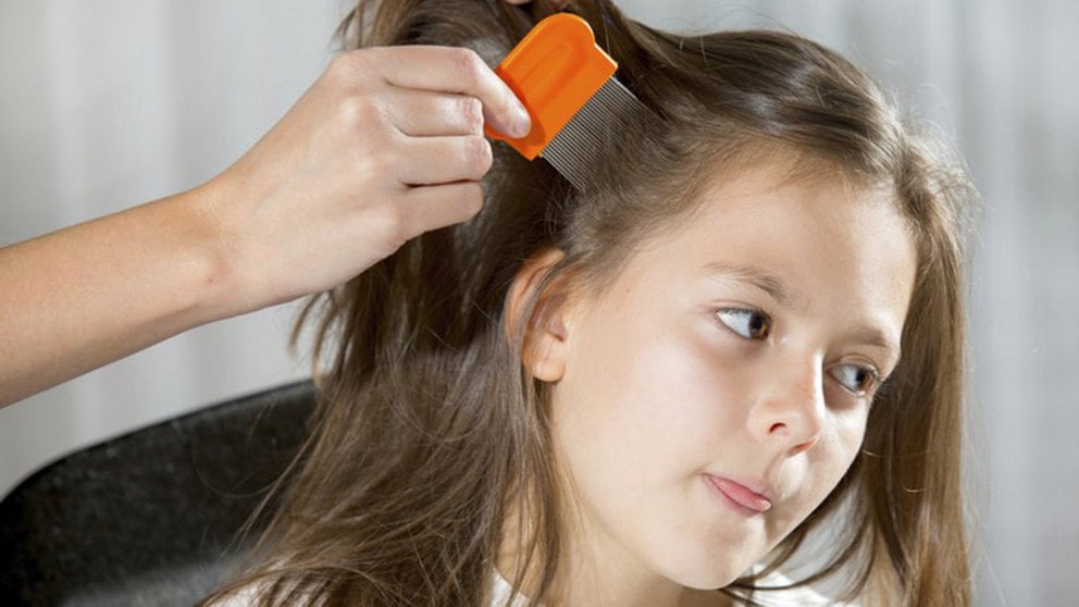 Una mujer pasa una lendrera por el pelo de una niña en busca de piojos ARCHIVO