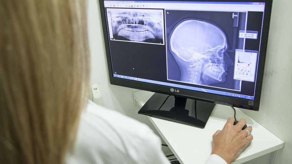 Una enfermera consultando una radiografía. ARCHIVO