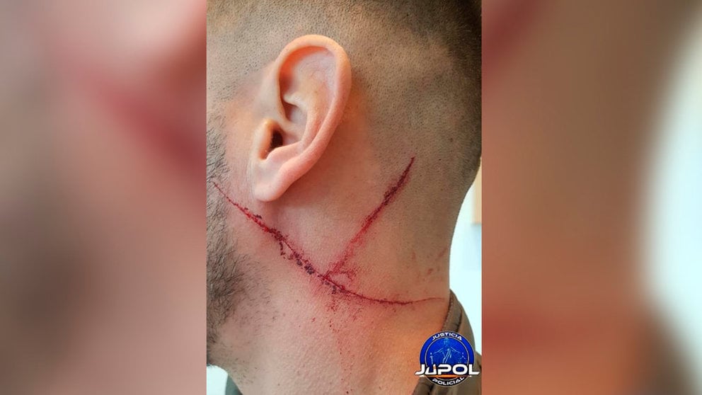 Heridas recibidas por un GEO fuera de servicio durante una discusión de tráfico en Alcorcón - JUPOL
