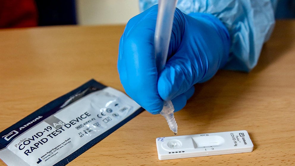 Material necesario para la realización de test de antígenos en un dispositivo organizado por la Comunidad de Madrid para la detección del Covid-19. RICARDO RUBIO (EUROPA PRESS)