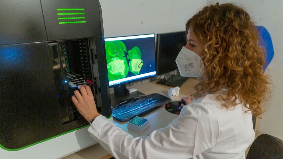 una investigadora del Programa de Tumores Sólidos del Cima Universidad de Navarra lleva a cabo un análisis de imagen de tejido mediante inmunofluorescencia. UNIVERSIDAD DE NAVARRA