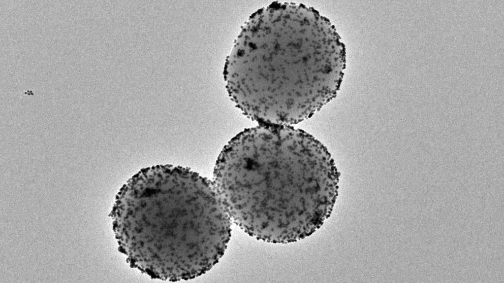 Imagen de microscopía electrónica de transmisión de los nanorrobots. Instituto de Bioingeniería de Cataluña (IBEC)